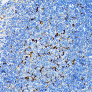 SMPD1 / Acid Sphingomyelinase Antibody - Immunohistochemistry of paraffin-embedded rat spleen tissue.