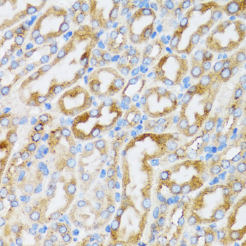 SMPD1 / Acid Sphingomyelinase Antibody - Immunohistochemistry of paraffin-embedded rat kidney tissue.