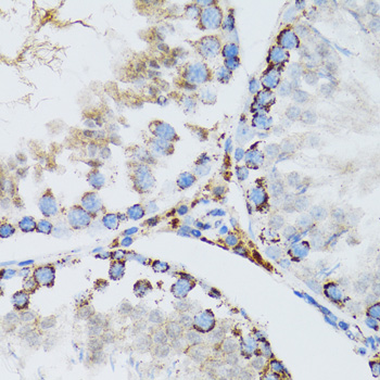 SMPD1 / Acid Sphingomyelinase Antibody - Immunohistochemistry of paraffin-embedded mouse testis tissue.