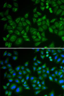 SMPD1 / Acid Sphingomyelinase Antibody - Immunofluorescence analysis of HeLa cells.