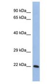 SMPD1 / Acid Sphingomyelinase Antibody - SMPD1 / Acid Sphingomyelinase antibody Western Blot of THP-1. Antibody dilution: 1 ug/ml.  This image was taken for the unconjugated form of this product. Other forms have not been tested.