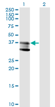 SMPD1 / Acid Sphingomyelinase Antibody - Western Blot analysis of SMPD1 expression in transfected 293T cell line by SMPD1 monoclonal antibody (M01), clone 4H2.Lane 1: SMPD1 transfected lysate(39.6 KDa).Lane 2: Non-transfected lysate.
