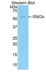 SMPD2 Antibody - Western blot of recombinant SMPD2.  This image was taken for the unconjugated form of this product. Other forms have not been tested.