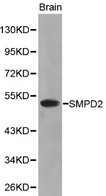 SMPD2 Antibody - Western blot of SMPD2 pAb in extracts from mouse brain tissue.