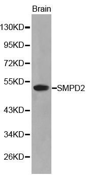 SMPD2 Antibody - Western blot analysis of brain tissue lysate.