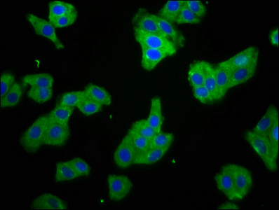SMPD2 Antibody - Immunofluorescence staining of HepG2 cells at a dilution of 1:66, counter-stained with DAPI. The cells were fixed in 4% formaldehyde, permeabilized using 0.2% Triton X-100 and blocked in 10% normal Goat Serum. The cells were then incubated with the antibody overnight at 4 °C.The secondary antibody was Alexa Fluor 488-congugated AffiniPure Goat Anti-Rabbit IgG (H+L) .