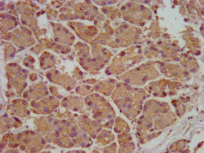 SMPD2 Antibody - Immunohistochemistry image at a dilution of 1:200 and staining in paraffin-embedded human pancreatic tissue performed on a Leica BondTM system. After dewaxing and hydration, antigen retrieval was mediated by high pressure in a citrate buffer (pH 6.0) . Section was blocked with 10% normal goat serum 30min at RT. Then primary antibody (1% BSA) was incubated at 4 °C overnight. The primary is detected by a biotinylated secondary antibody and visualized using an HRP conjugated SP system.