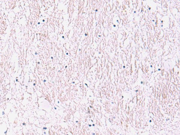 SMPD2 Antibody - Immunohistochemistry of paraffin-embedded Human brain tissue  using SMPD2 Polyclonal Antibody at dilution of 1:90(×200)