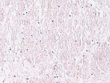 SMPD2 Antibody - Immunohistochemistry of paraffin-embedded Human brain tissue  using SMPD2 Polyclonal Antibody at dilution of 1:90(×200)