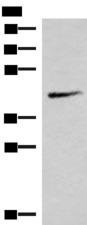 SMPD2 Antibody - Western blot analysis of Mouse lung tissue lysate  using SMPD2 Polyclonal Antibody at dilution of 1:1000