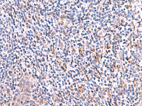 SMPD2 Antibody - Immunohistochemistry of paraffin-embedded Human tonsil tissue  using SMPD2 Polyclonal Antibody at dilution of 1:70(×200)