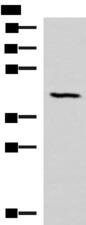 SMPD2 Antibody - Western blot analysis of Mouse lung tissue lysate  using SMPD2 Polyclonal Antibody at dilution of 1:1000
