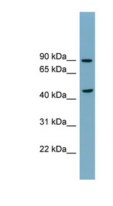 SMPD2 Antibody - SMPD2 antibody Western blot of COLO205 cell lysate. This image was taken for the unconjugated form of this product. Other forms have not been tested.