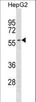 SMPD3 / NSMASE2 Antibody - SMPD3 Antibody western blot of HepG2 cell line lysates (35 ug/lane). The SMPD3 antibody detected the SMPD3 protein (arrow).