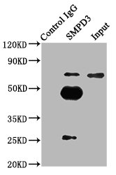 SMPD3 / NSMASE2 Antibody - Immunoprecipitating SMPD3 in mouse brain whole cell lysate Lane 1: Rabbit control IgG (1µg) instead of SMPD3 Antibody in mouse brain whole cell lysate.For western blotting, a HRP-conjugated Protein G antibody was used as the secondary antibody (1/2000) Lane 2: SMPD3 Antibody (6µg) + Mouse brain whole cell lysate (500µg) Lane 3: Mouse brain whole cell lysate (10µg)