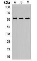 SMPD3 / NSMASE2 Antibody