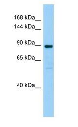 SMPD4 Antibody - SMPD4 antibody Western Blot of Rat Testis.  This image was taken for the unconjugated form of this product. Other forms have not been tested.