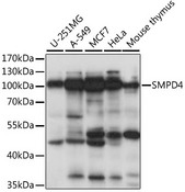 SMPD4 Antibody - Western blot analysis of extracts of various cell lines, using SMPD4 antibody at 1:1000 dilution. The secondary antibody used was an HRP Goat Anti-Rabbit IgG (H+L) at 1:10000 dilution. Lysates were loaded 25ug per lane and 3% nonfat dry milk in TBST was used for blocking. An ECL Kit was used for detection and the exposure time was 5s.