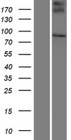 SMPD4 Protein - Western validation with an anti-DDK antibody * L: Control HEK293 lysate R: Over-expression lysate