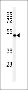 SMPDL3A Antibody - Western blot of ASM3A Antibody in MDA-MB435 cell line lysates (35 ug/lane). ASM3A (arrow) was detected using the purified antibody.