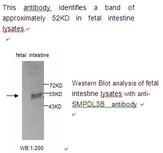 SMPDL3B Antibody