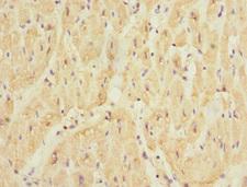 SMPX Antibody - Immunohistochemistry of paraffin-embedded human heart tissue at dilution 1:100