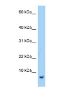 SMR3B Antibody - SMR3B antibody Western blot of 293T Cell lysate. Antibody concentration 1 ug/ml.  This image was taken for the unconjugated form of this product. Other forms have not been tested.