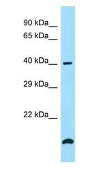 SMS / Spermine Synthase Antibody - SMS / Spermine Synthase antibody Western Blot of MCF7.  This image was taken for the unconjugated form of this product. Other forms have not been tested.