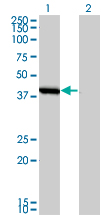 SMS / Spermine Synthase Antibody - Western Blot analysis of SMS expression in transfected 293T cell line by SMS monoclonal antibody (M01), clone 1G6.Lane 1: SMS transfected lysate(41.268 KDa).Lane 2: Non-transfected lysate.