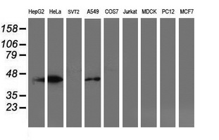 SMS / Spermine Synthase Antibody - Western blot of extracts (35 ug) from 9 different cell lines by using anti-SMS monoclonal antibody (HepG2: human; HeLa: human; SVT2: mouse; A549: human; COS7: monkey; Jurkat: human; MDCK: canine; PC12: rat; MCF7: human).