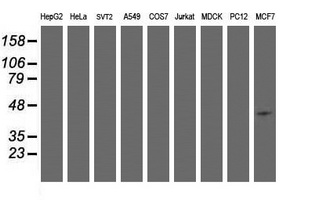 SMS / Spermine Synthase Antibody - Western blot of extracts (35 ug) from 9 different cell lines by using anti-SMS monoclonal antibody (HepG2: human; HeLa: human; SVT2: mouse; A549: human; COS7: monkey; Jurkat: human; MDCK: canine; PC12: rat; MCF7: human).
