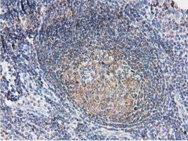 SMS / Spermine Synthase Antibody - IHC of paraffin-embedded Human lymph node tissue using anti-SMS mouse monoclonal antibody.