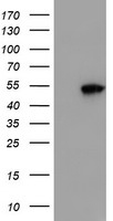 SMS / Spermine Synthase Antibody - HEK293T cells were transfected with the pCMV6-ENTRY control (Left lane) or pCMV6-ENTRY SMS (Right lane) cDNA for 48 hrs and lysed. Equivalent amounts of cell lysates (5 ug per lane) were separated by SDS-PAGE and immunoblotted with anti-SMS.