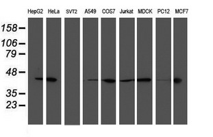 SMS / Spermine Synthase Antibody - Western blot of extracts (35 ug) from 9 different cell lines by using anti-SMS monoclonal antibody.