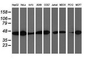 SMS / Spermine Synthase Antibody - Western blot of extracts (35 ug) from 9 different cell lines by using anti-SMS monoclonal antibody.