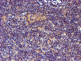 SMS / Spermine Synthase Antibody - IHC of paraffin-embedded Human lymphoma tissue using anti-SMS mouse monoclonal antibody.