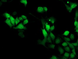 SMS / Spermine Synthase Antibody - Immunofluorescent staining of HeLa cells using anti-SMS mouse monoclonal antibody.
