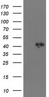 SMS / Spermine Synthase Antibody - HEK293T cells were transfected with the pCMV6-ENTRY control (Left lane) or pCMV6-ENTRY SMS (Right lane) cDNA for 48 hrs and lysed. Equivalent amounts of cell lysates (5 ug per lane) were separated by SDS-PAGE and immunoblotted with anti-SMS.