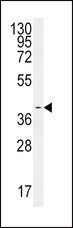 SMS / Spermine Synthase Antibody - SMS Antibody western blot of HeLa cell line lysates (35 ug/lane). The SMS antibody detected the SMS protein (arrow).