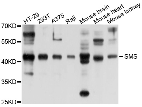 SMS / Spermine Synthase Antibody - Western blot analysis of extracts of various cells.
