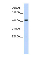 SMS2 / SGMS2 Antibody - SGMS2 antibody Western blot of Fetal Heart lysate. This image was taken for the unconjugated form of this product. Other forms have not been tested.