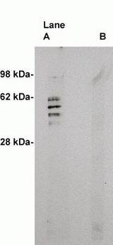 SMS2 / SGMS2 Antibody - Western blot on human brain lysate (10 ug/lane) using X2059P antibody to Sphingomyelin Synthase 2 (0.5 ug/ml). Lane A] 1 ug/ml antibody alone, lane B] antibody plus 3 ug blocking peptide. Blot was developed with Pierce Super System West Femto - 1 minute exposure.
