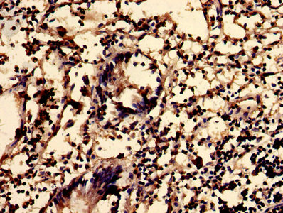 SMS2 / SGMS2 Antibody - IHC image of SGMS2 Antibody diluted at 1:600 and staining in paraffin-embedded human appendix tissue performed on a Leica BondTM system. After dewaxing and hydration, antigen retrieval was mediated by high pressure in a citrate buffer (pH 6.0). Section was blocked with 10% normal goat serum 30min at RT. Then primary antibody (1% BSA) was incubated at 4°C overnight. The primary is detected by a biotinylated secondary antibody and visualized using an HRP conjugated SP system.