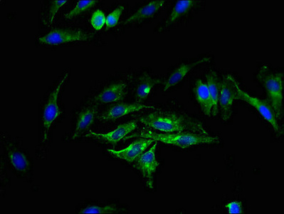 SMS2 / SGMS2 Antibody - Immunofluorescence staining of Hela cells with SGMS2 Antibody at 1:200, counter-stained with DAPI. The cells were fixed in 4% formaldehyde, permeabilized using 0.2% Triton X-100 and blocked in 10% normal Goat Serum. The cells were then incubated with the antibody overnight at 4°C. The secondary antibody was Alexa Fluor 488-congugated AffiniPure Goat Anti-Rabbit IgG(H+L).