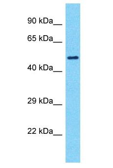 SMTNL1 Antibody - SMTNL1 antibody Western Blot of Jurkat. Antibody dilution: 1 ug/ml.  This image was taken for the unconjugated form of this product. Other forms have not been tested.