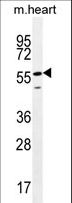 SMTNL2 Antibody - SMTNL2 Antibody western blot of mouse heart tissue lysates (35 ug/lane). The SMTNL2 antibody detected the SMTNL2 protein (arrow).