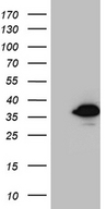 SMUG1 Antibody - HEK293T cells were transfected with the pCMV6-ENTRY control. (Left lane) or pCMV6-ENTRY SMUG1. (Right lane) cDNA for 48 hrs and lysed. Equivalent amounts of cell lysates. (5 ug per lane) were separated by SDS-PAGE and immunoblotted with anti-SMUG1. (1:2000)