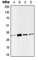SMUG1 Antibody - Western blot analysis of SMUG1 expression in HeLa (A); Molt4 (B); Raw264.7 (C); H9C2 (D) whole cell lysates.
