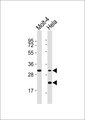 SMUG1 Antibody - All lanes : Anti-SMUG1 Antibody at 1:1000 dilution Lane 1: Molt-4 whole cell lysates Lane 2: HeLa whole cell lysates Lysates/proteins at 20 ug per lane. Secondary Goat Anti-Rabbit IgG, (H+L),Peroxidase conjugated at 1/10000 dilution Predicted band size : 30 kDa Blocking/Dilution buffer: 5% NFDM/TBST.