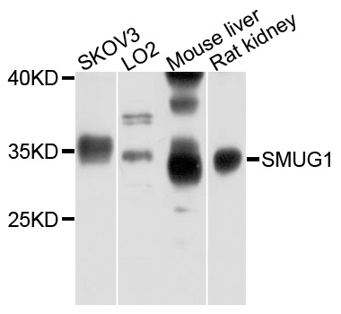 SMUG1 Antibody - Western blot analysis of extracts of various cells.